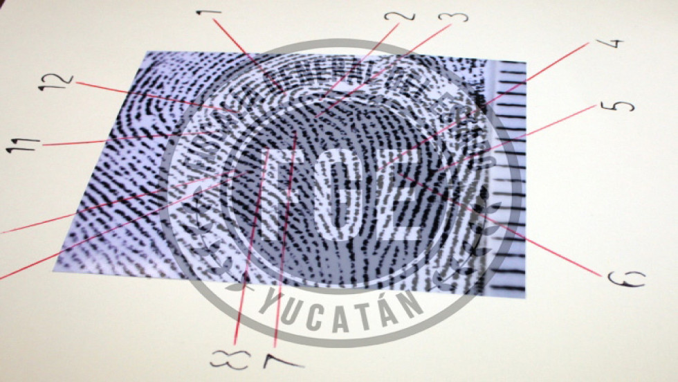 Imputado por lesionar a vecino de la Xoclán López Portillo